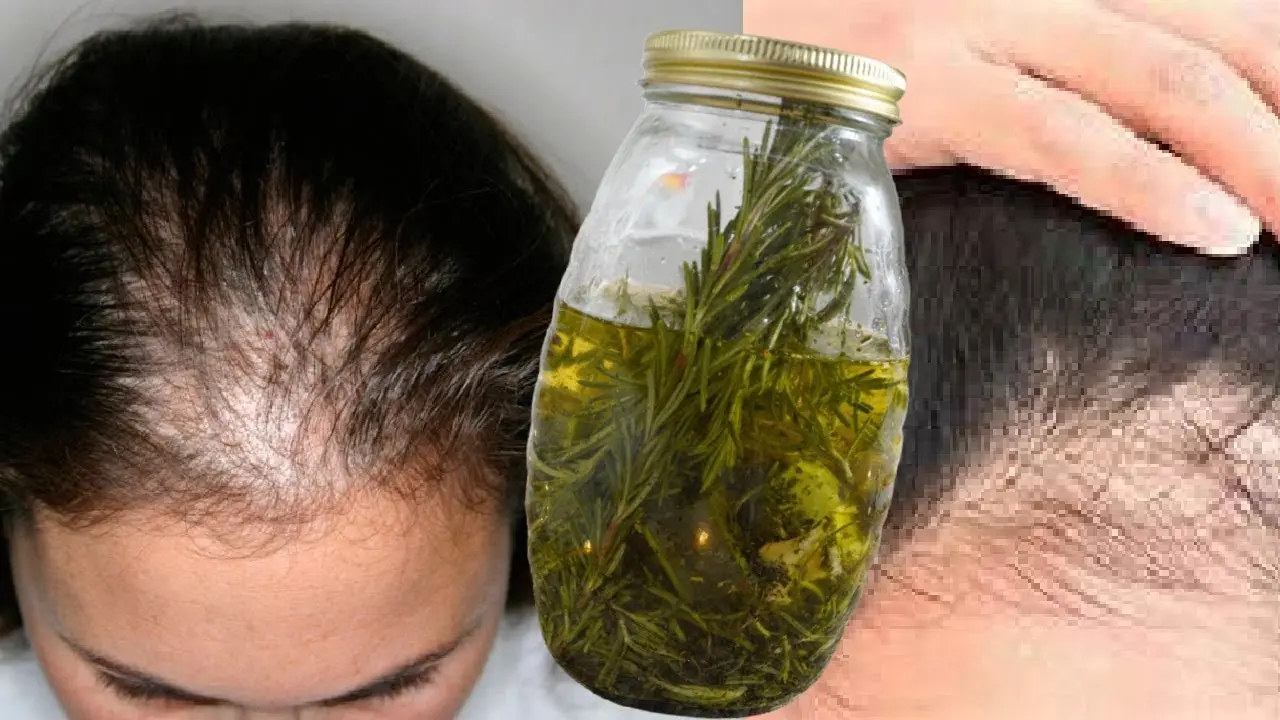 Tratamientos Caseros para la Caída del Cabello en Mujeres.